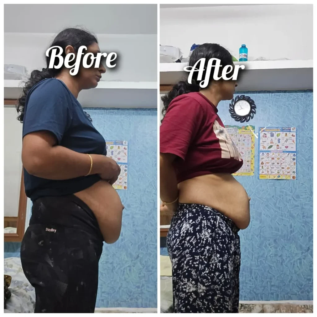 Before - After Transformation (11)