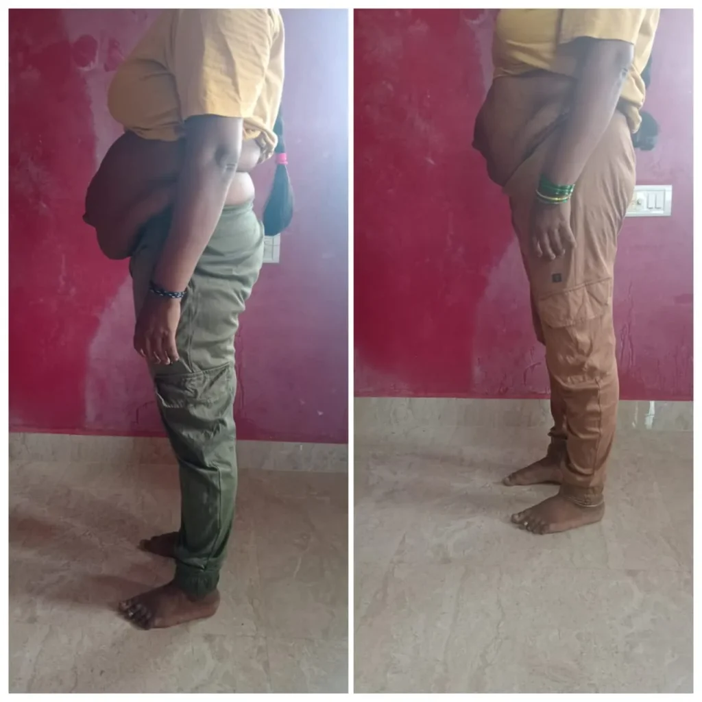 Before - After Transformation (12)