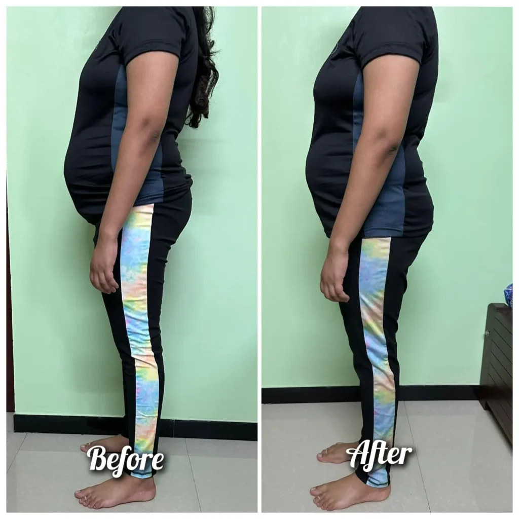 Before - After Transformation (13)