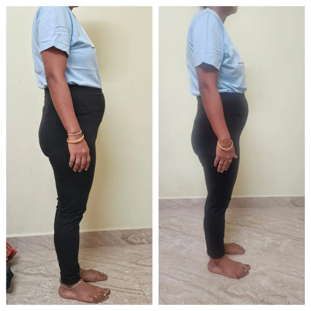 Before - After Transformation (14)