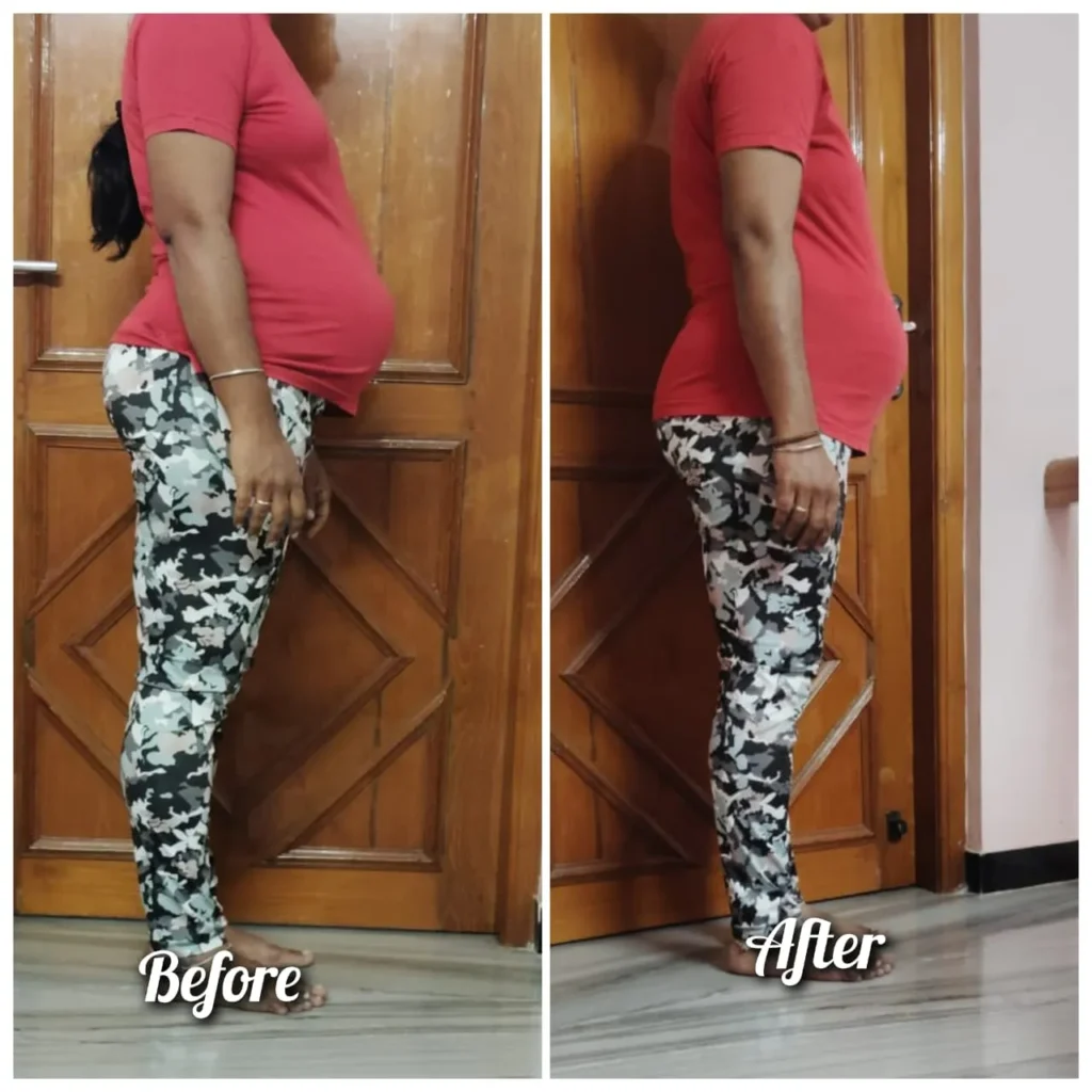 Before - After Transformation (16)