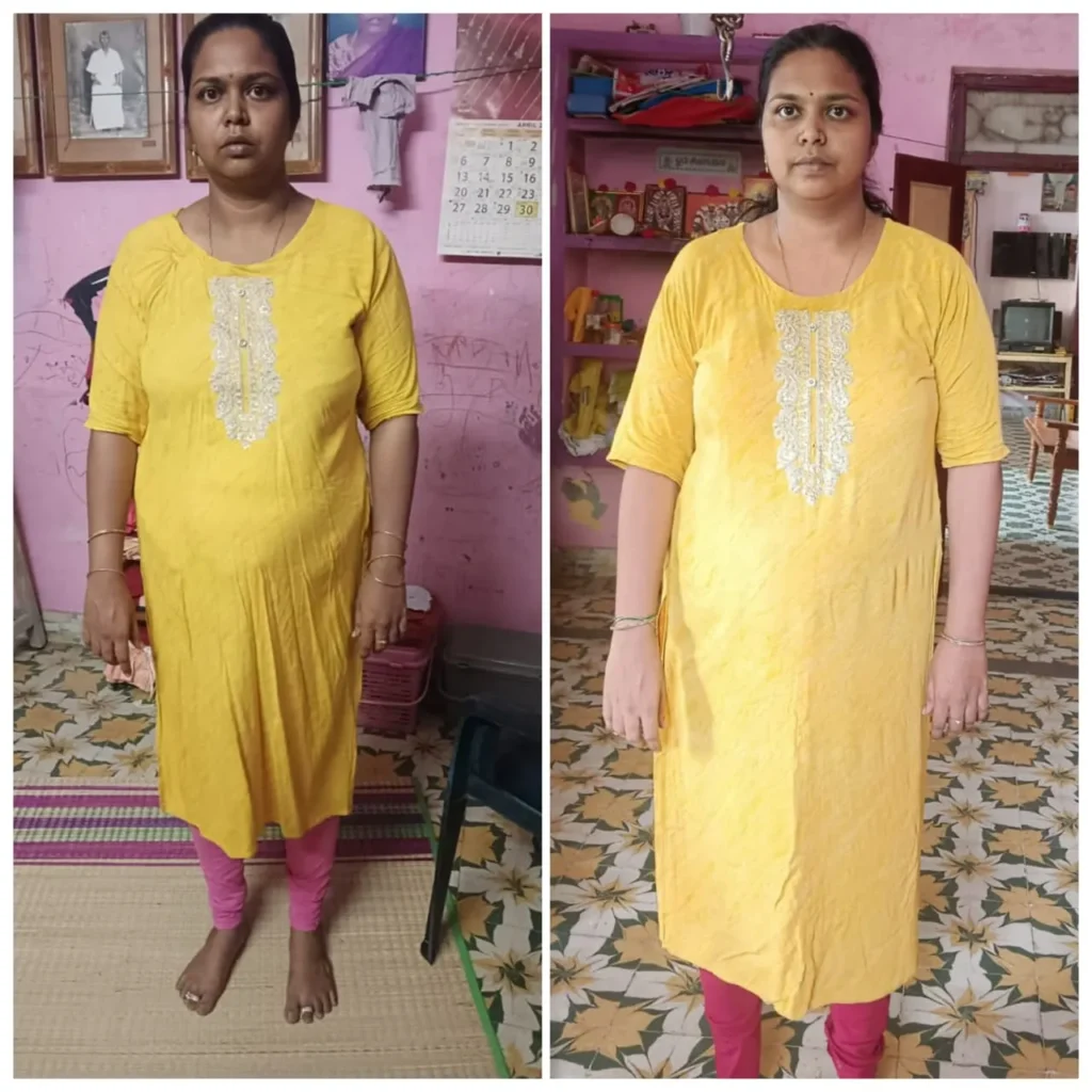 Before - After Transformation (17)