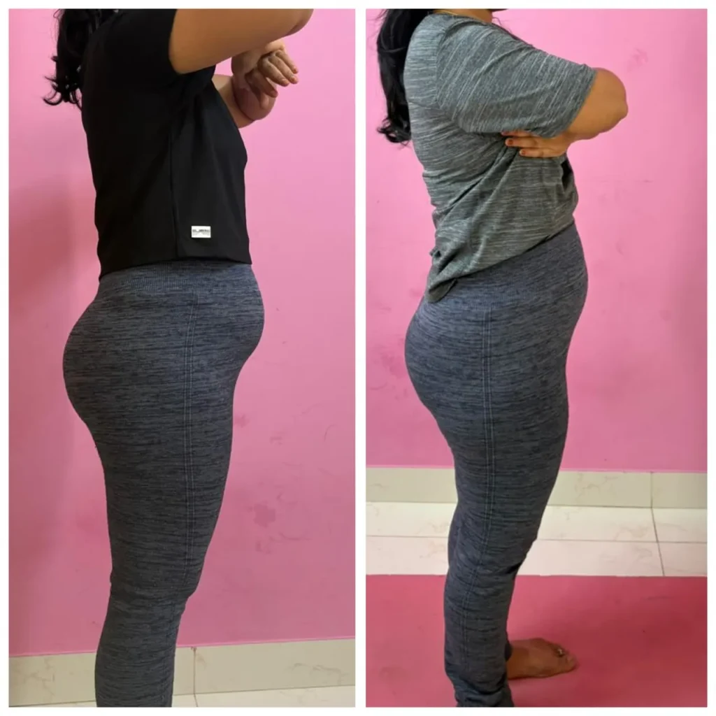 Before - After Transformation (18)