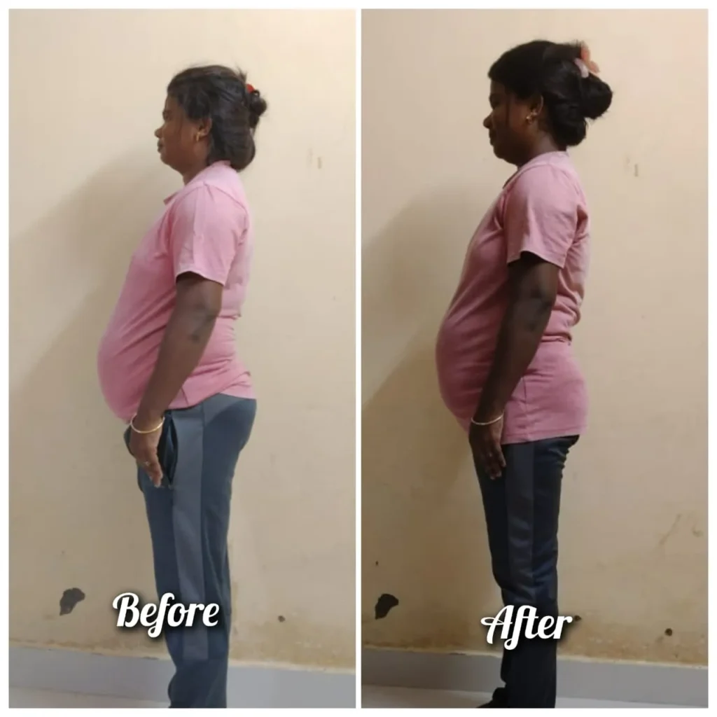 Before - After Transformation (19)