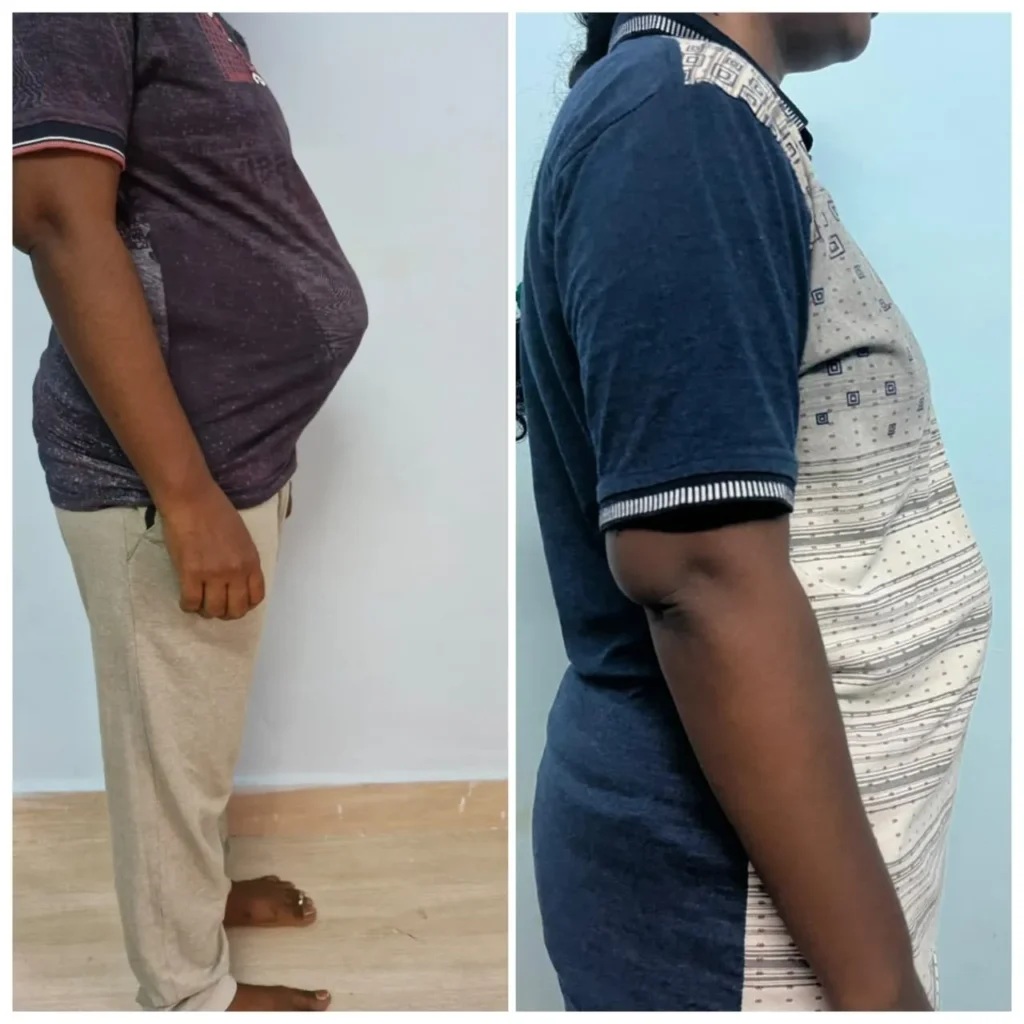 Before - After Transformation (22)