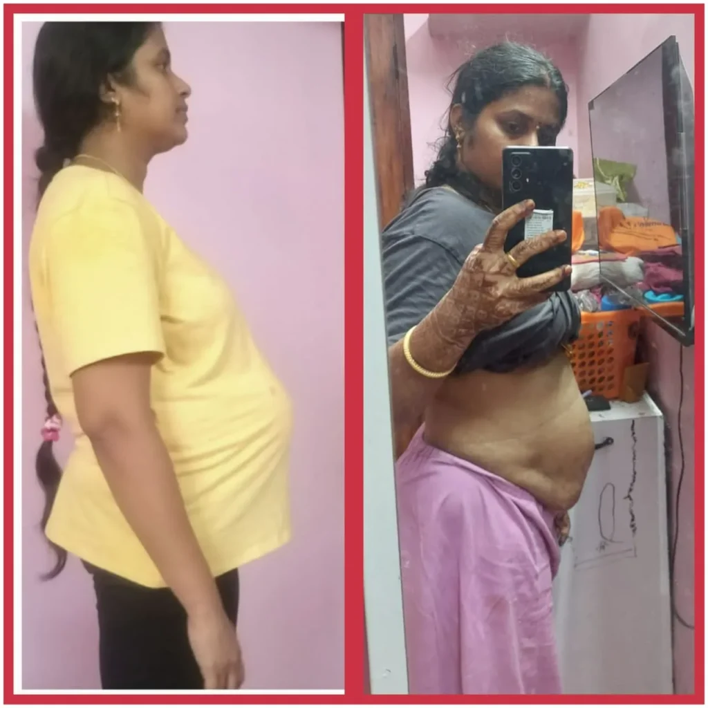 Before - After Transformation (27)