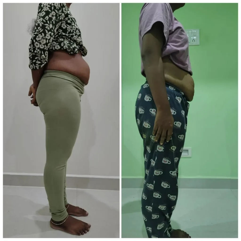 Before - After Transformation (3)