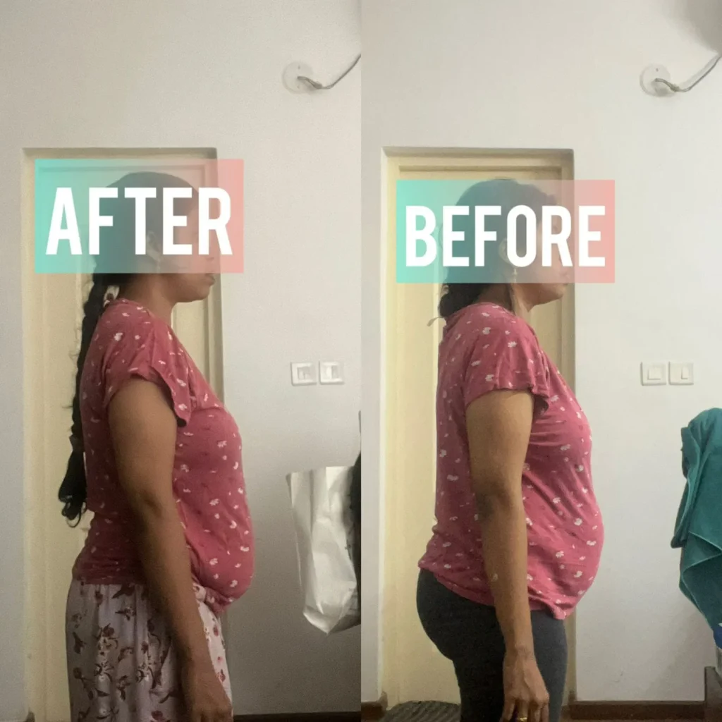 Before - After Transformation (31)