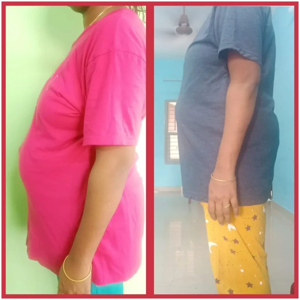 Before - After Transformation (32)