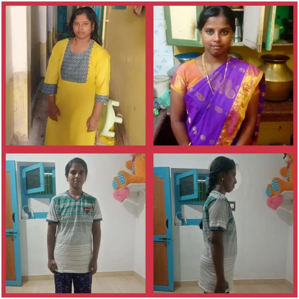 Before - After Transformation (34)