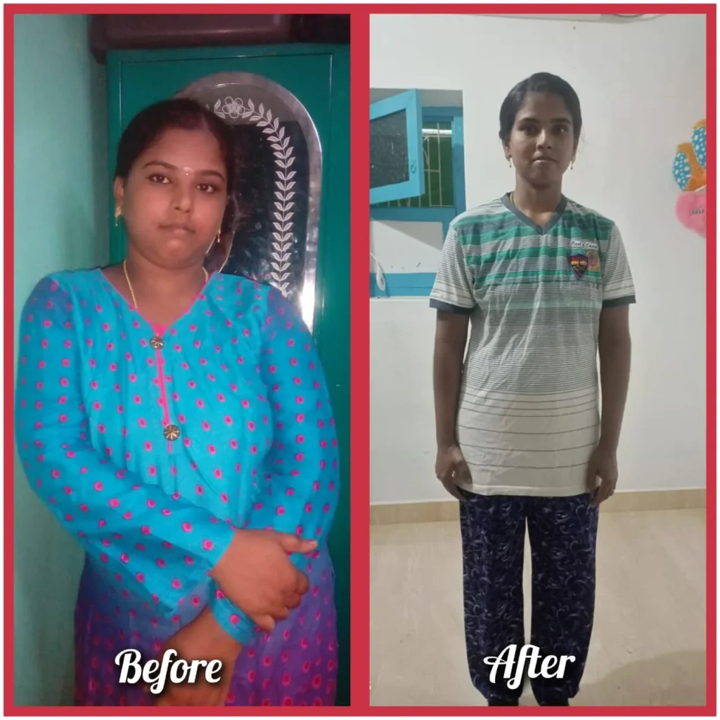 Before - After Transformation (37)