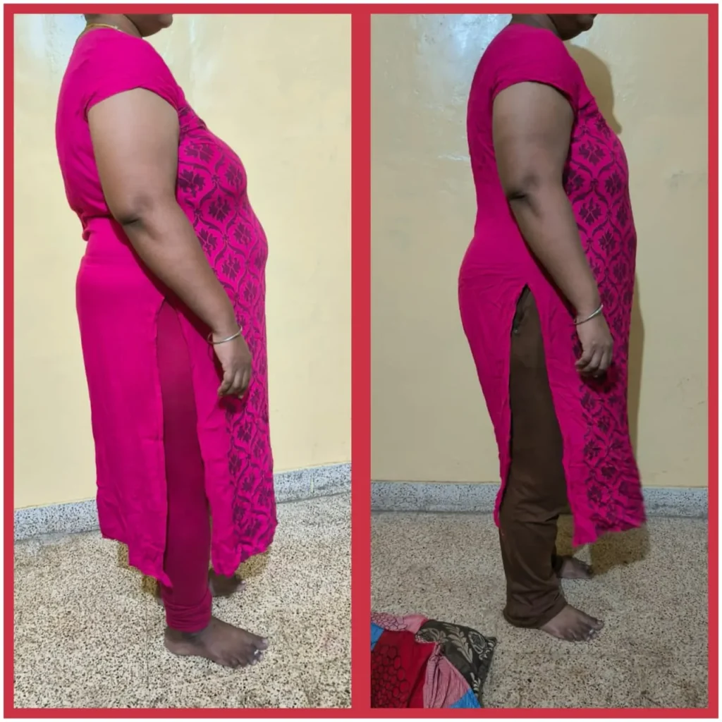 Before - After Transformation (38)