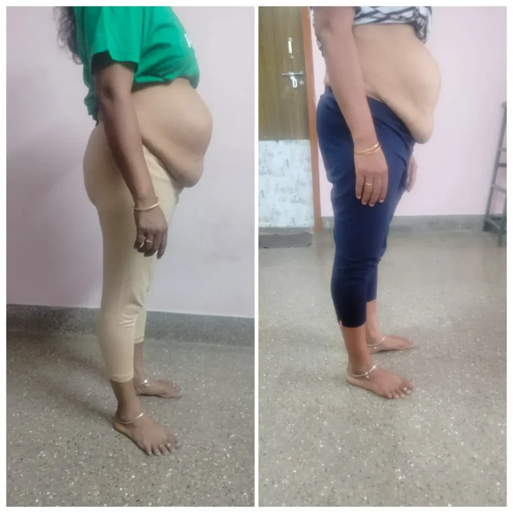 Before - After Transformation (4)