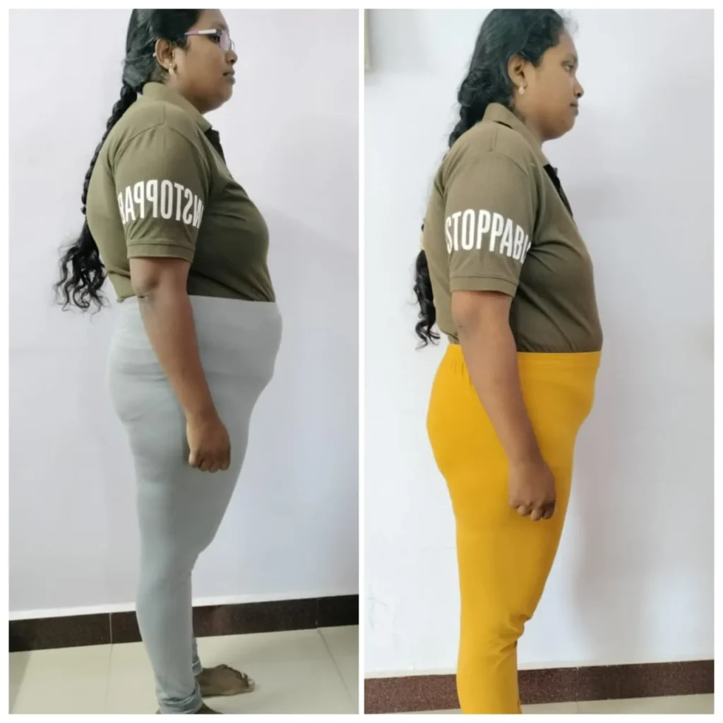 Before - After Transformation (5)