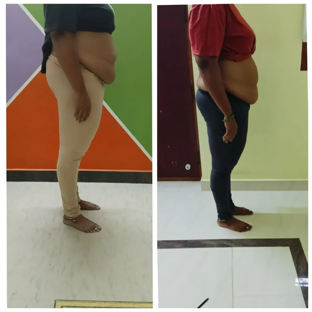 Before - After Transformation (6)