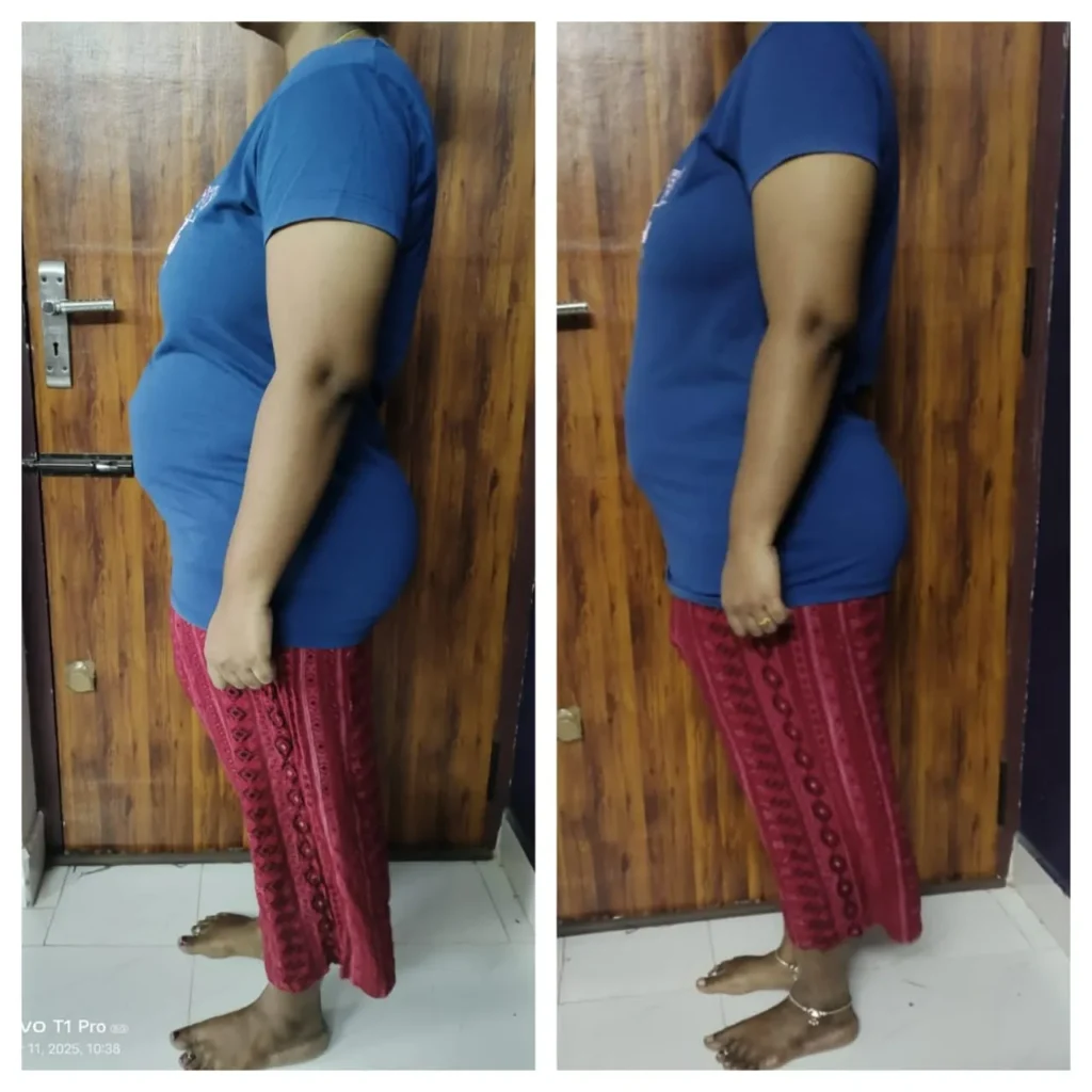 Before - After Transformation (7)