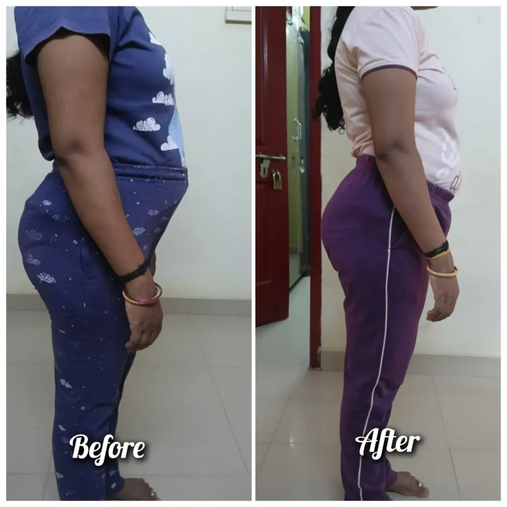 Before - After Transformation (9)